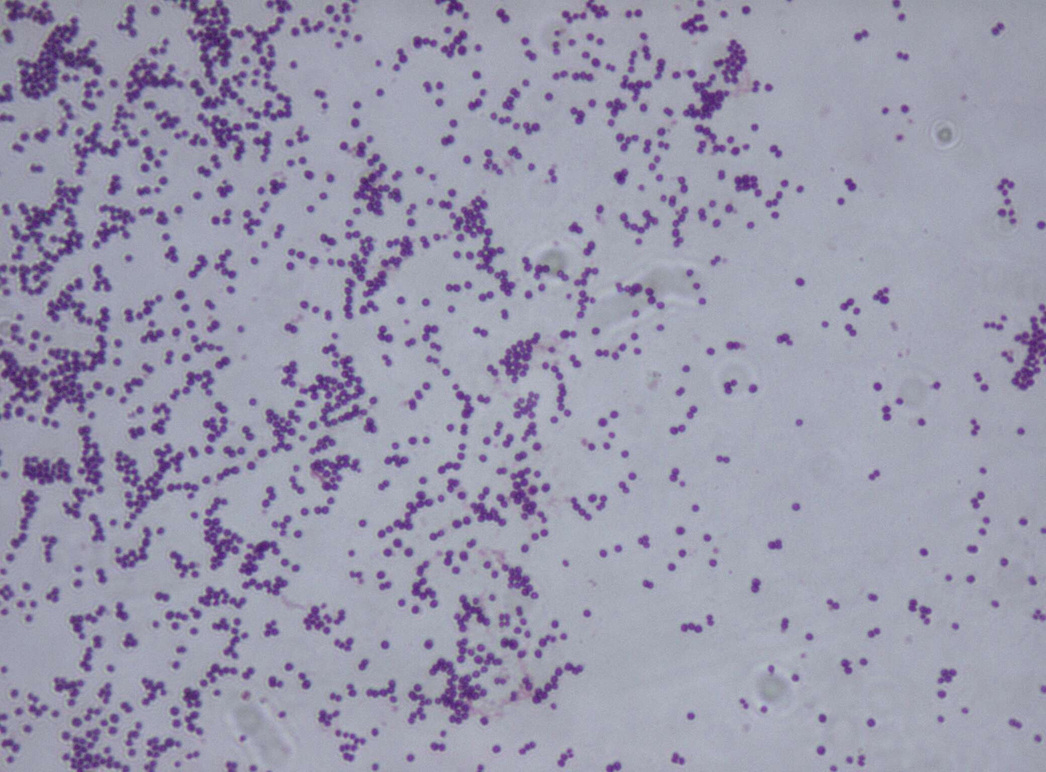 Image of Staphylococcus saprophyticus