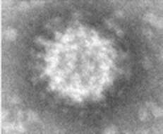 Image of Banna virus