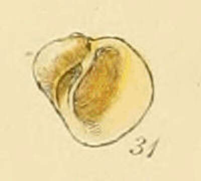 Image of pale lacuna