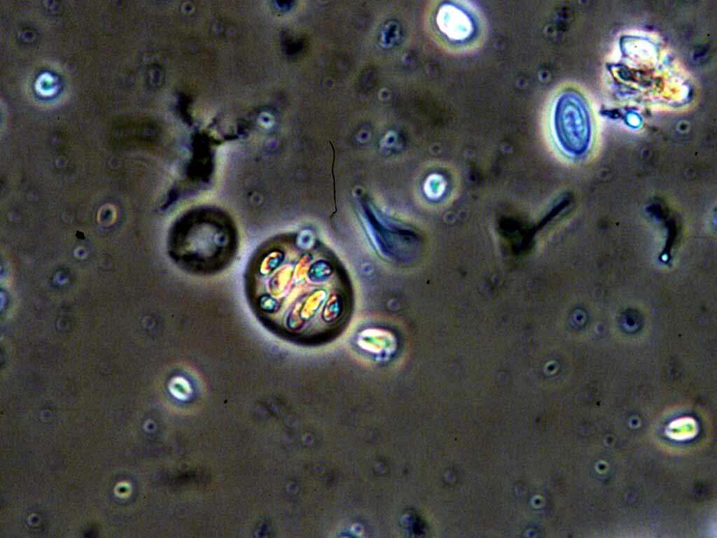 Imagem de Nephrocytium Nägeli 1849