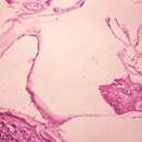 Image of Echinococcus vogeli