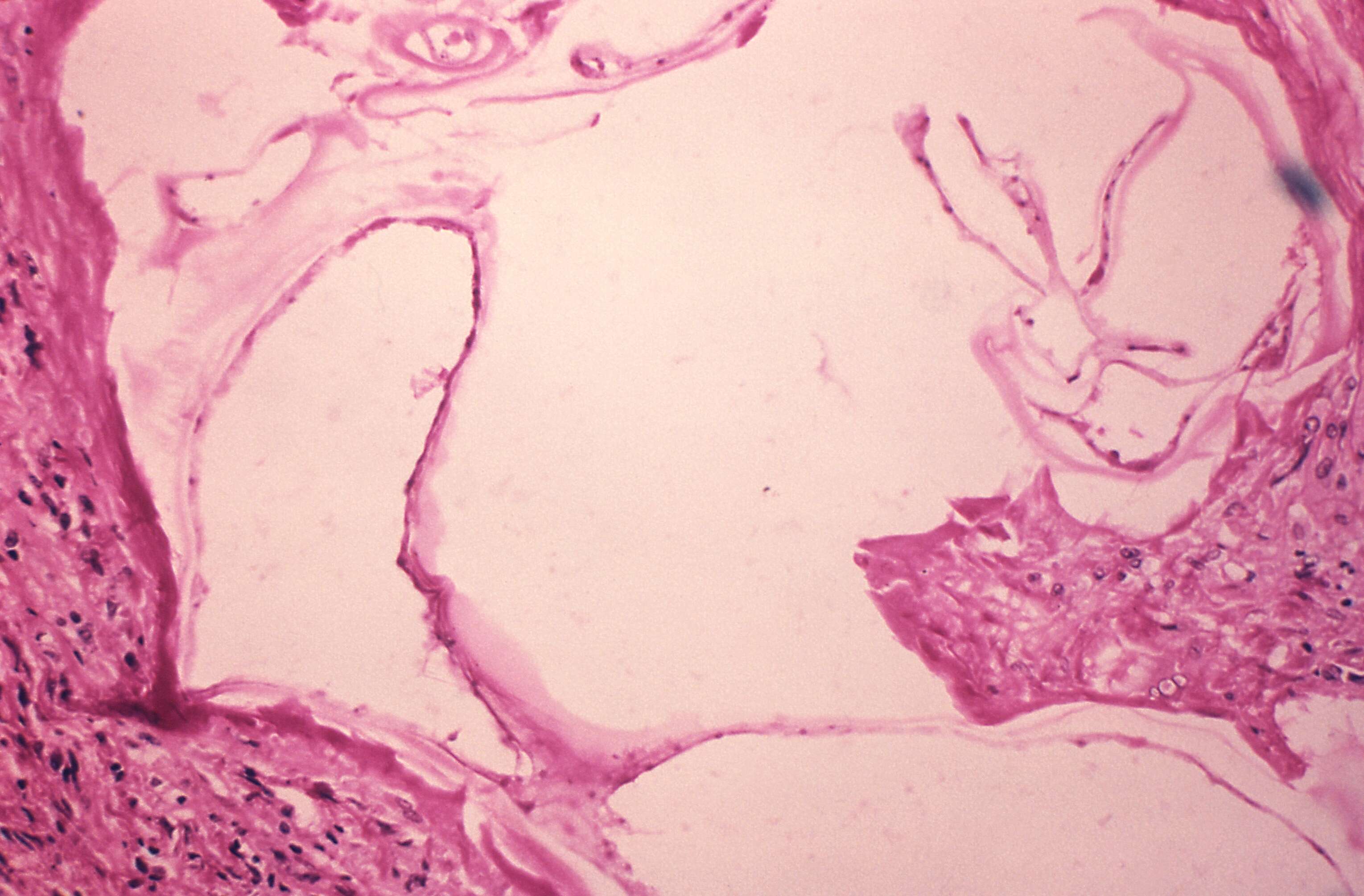 Image of Echinococcus vogeli