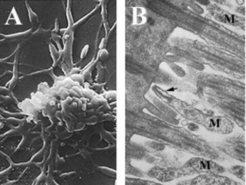 Image de Mycoplasma pneumoniae