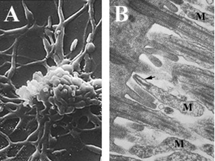 Image of Mycoplasma pneumoniae