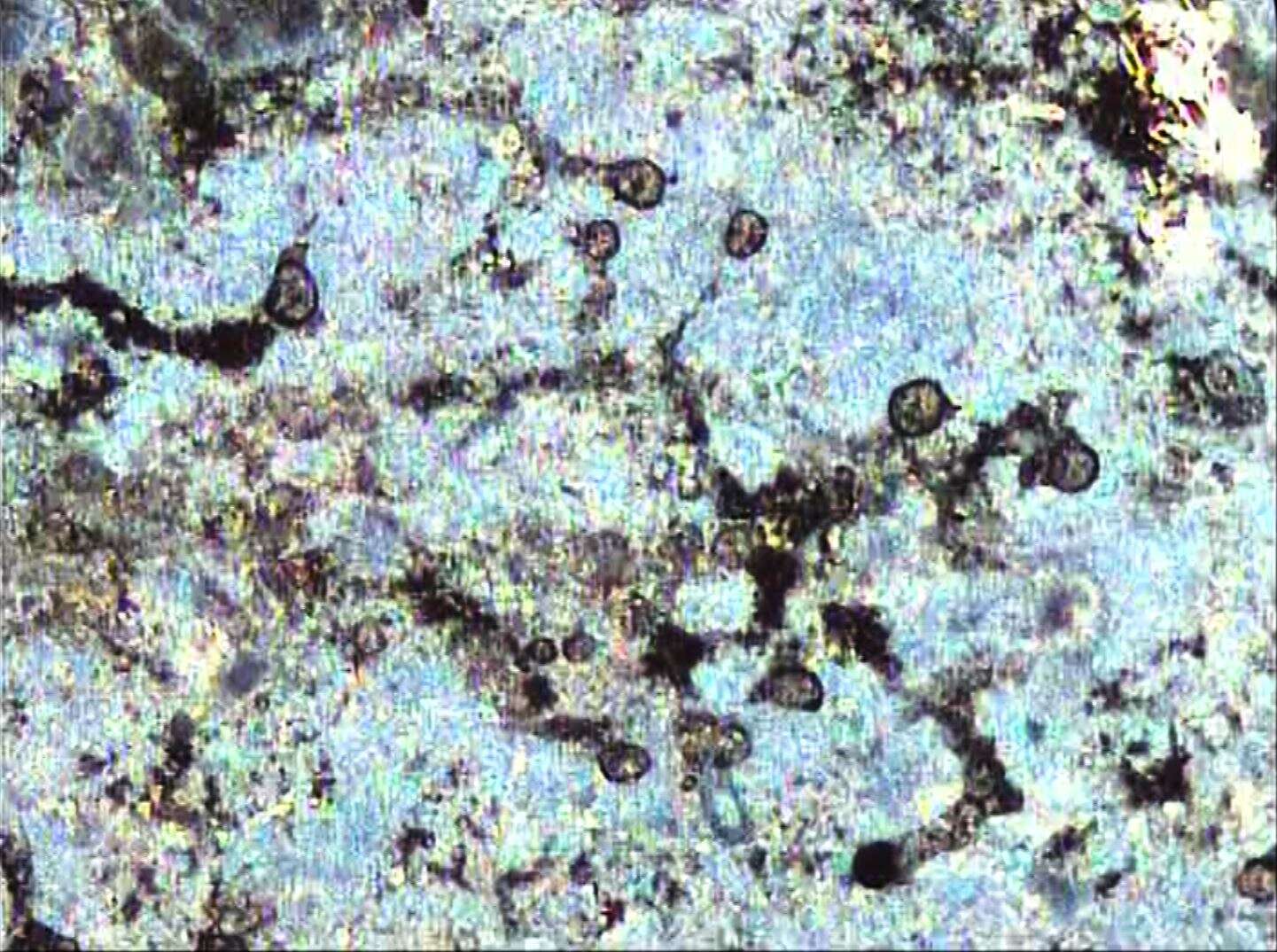 Image of Amoebidae