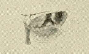 Image of Diceratura infantana Kennel 1899