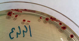 Image de Campylobacter jejuni