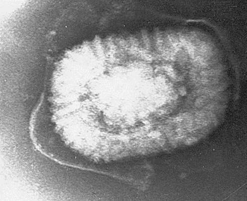 Image of Myxoma virus