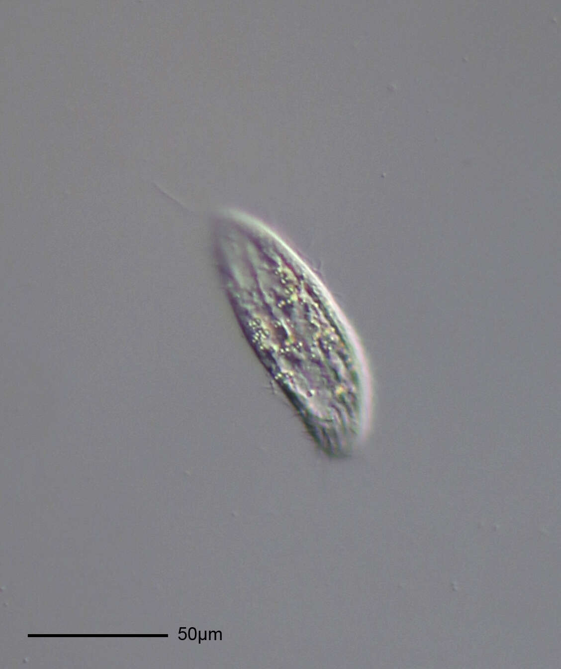 Image of ciliates