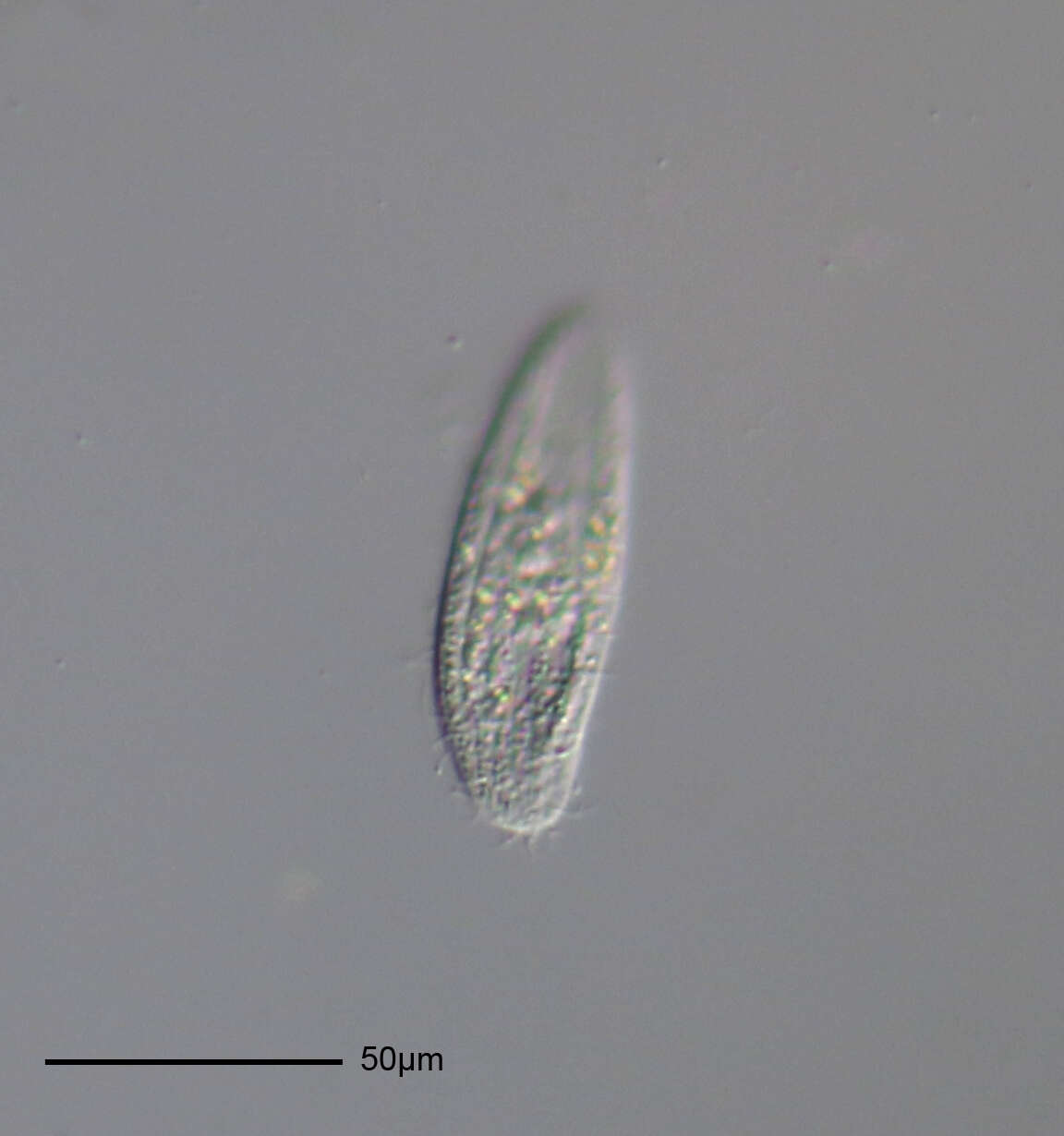 Image of ciliates