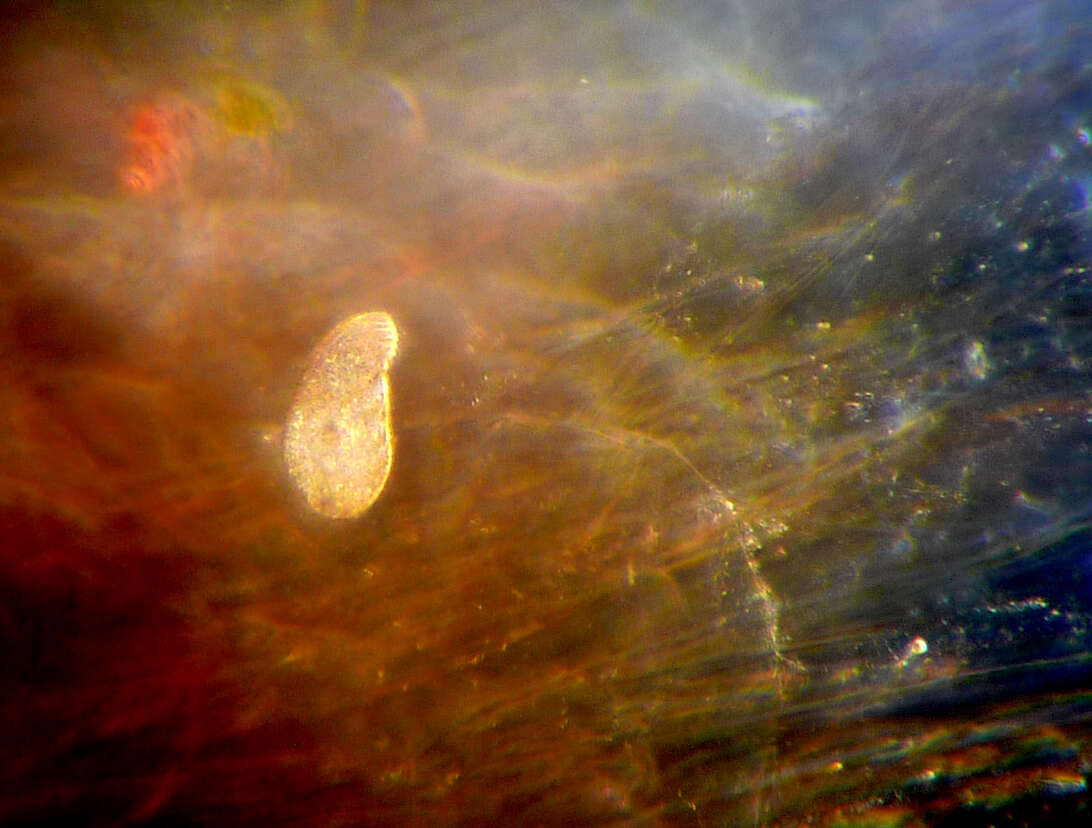 Image of ciliates