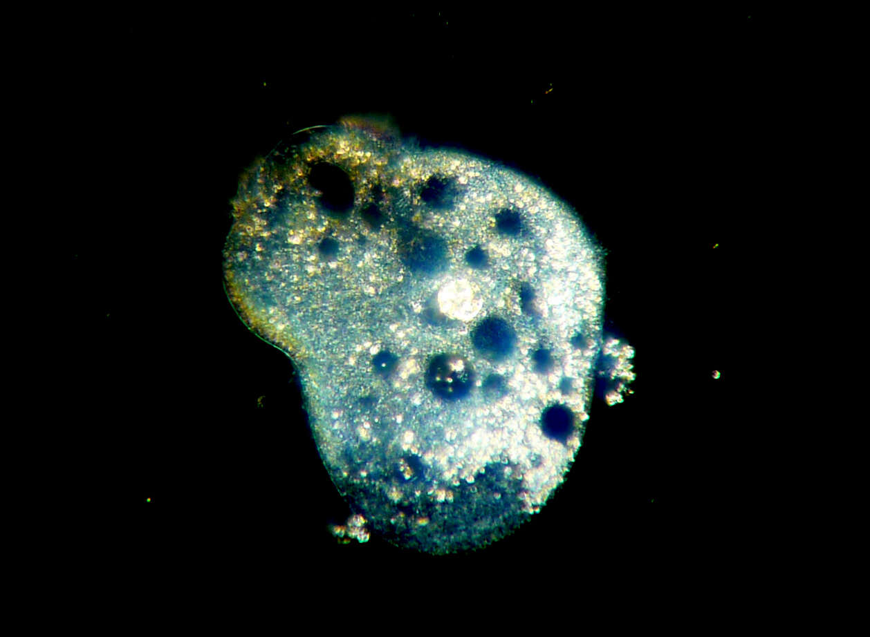 Image of ciliates