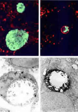 Image of Chlamydia trachomatis