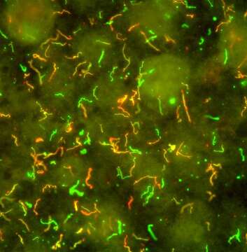 Image de Borreliella burgdorferi