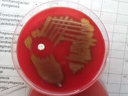 Imagem de Streptococcus pneumoniae