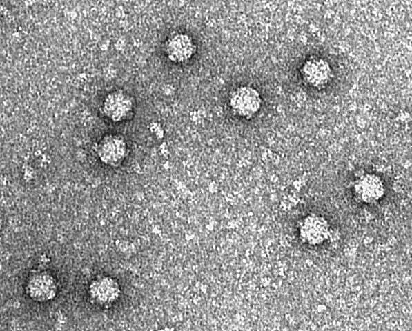 Imagem de Enterobacteria phage phiX174