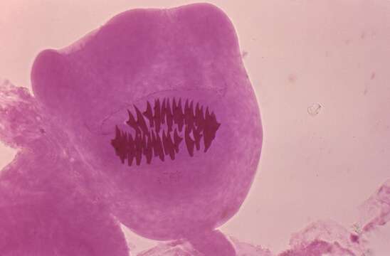 Image of Echinococcus