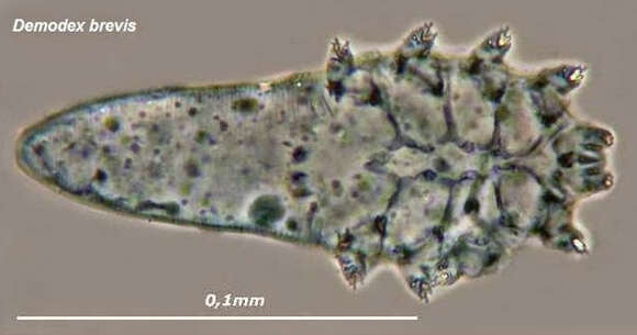 Image of Demodex brevis Akbulatova 1963