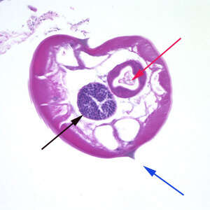 Image of Pinworm