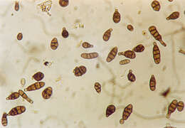 Image of Alternaria