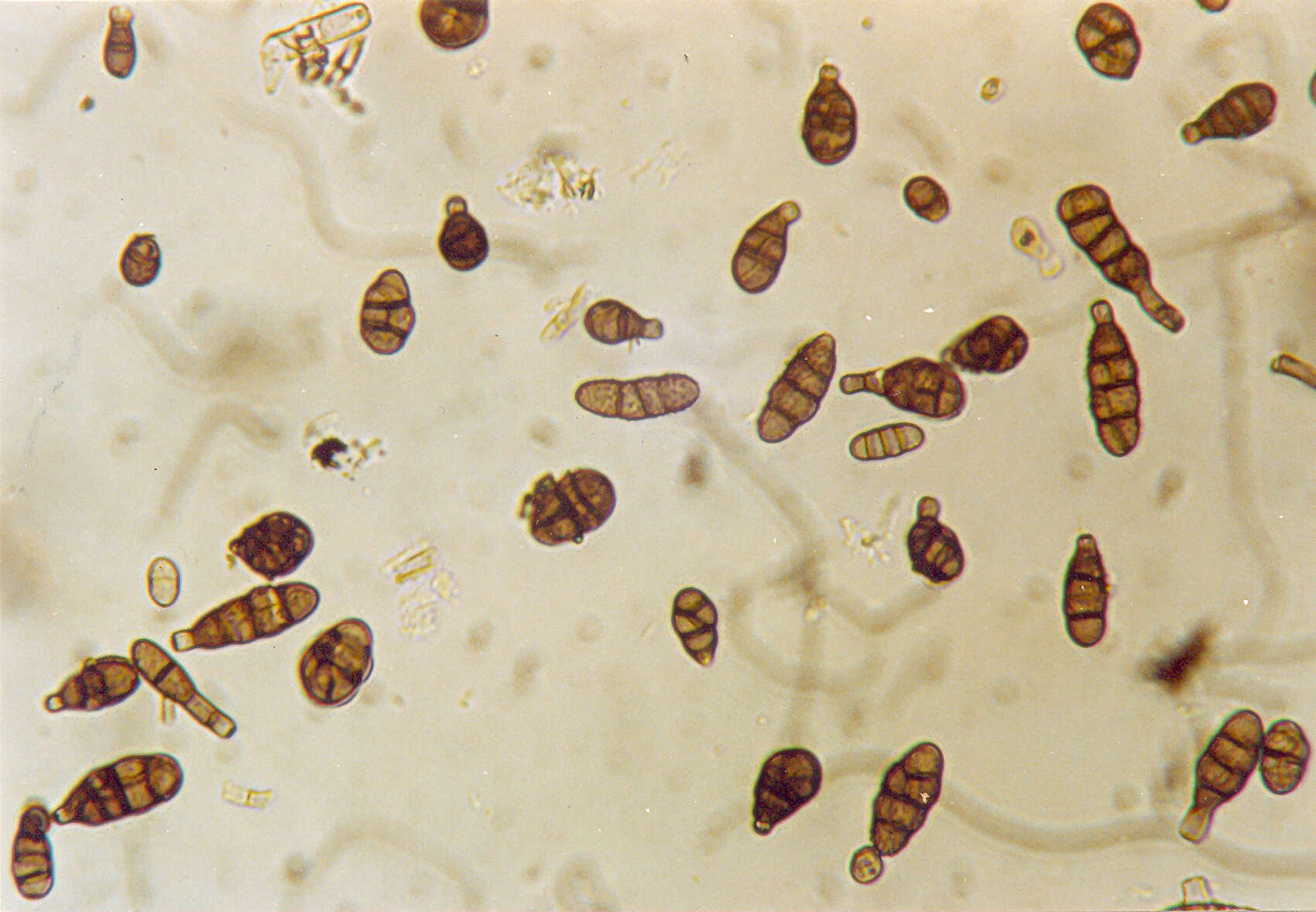 Image of Alternaria