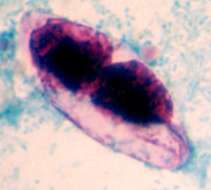 Image of Cystoisospora