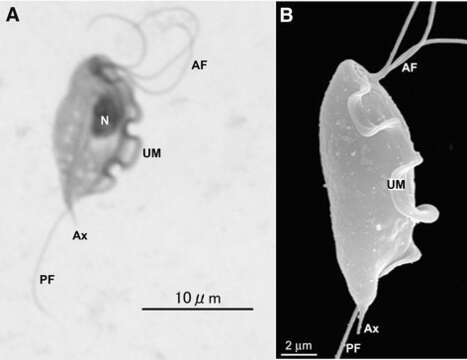 Image of Trichomonas Donné