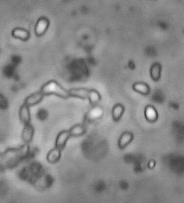 Image of Ordospora colligata