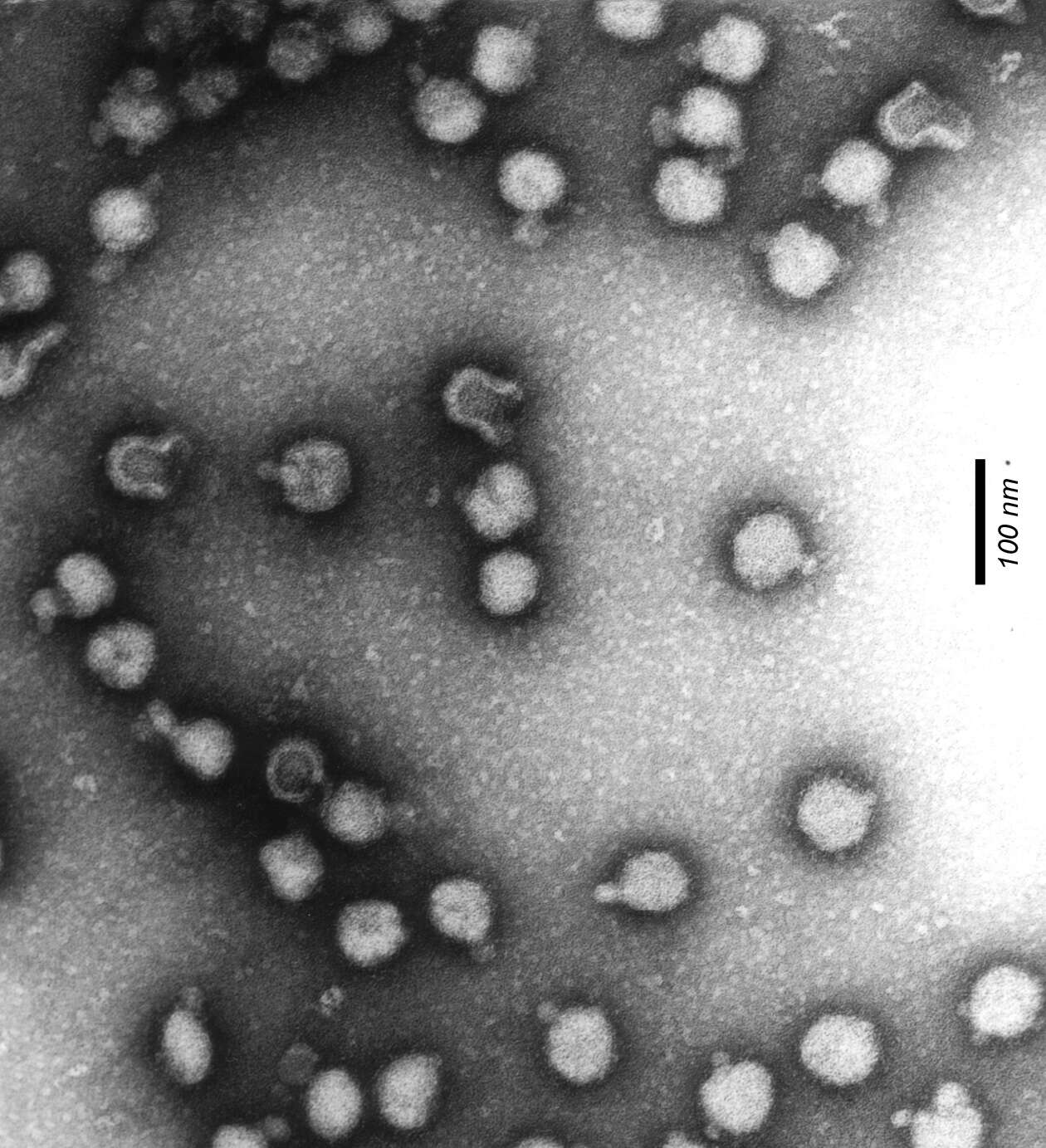 Image of Semliki Forest virus