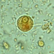 Image of Entamoebidae