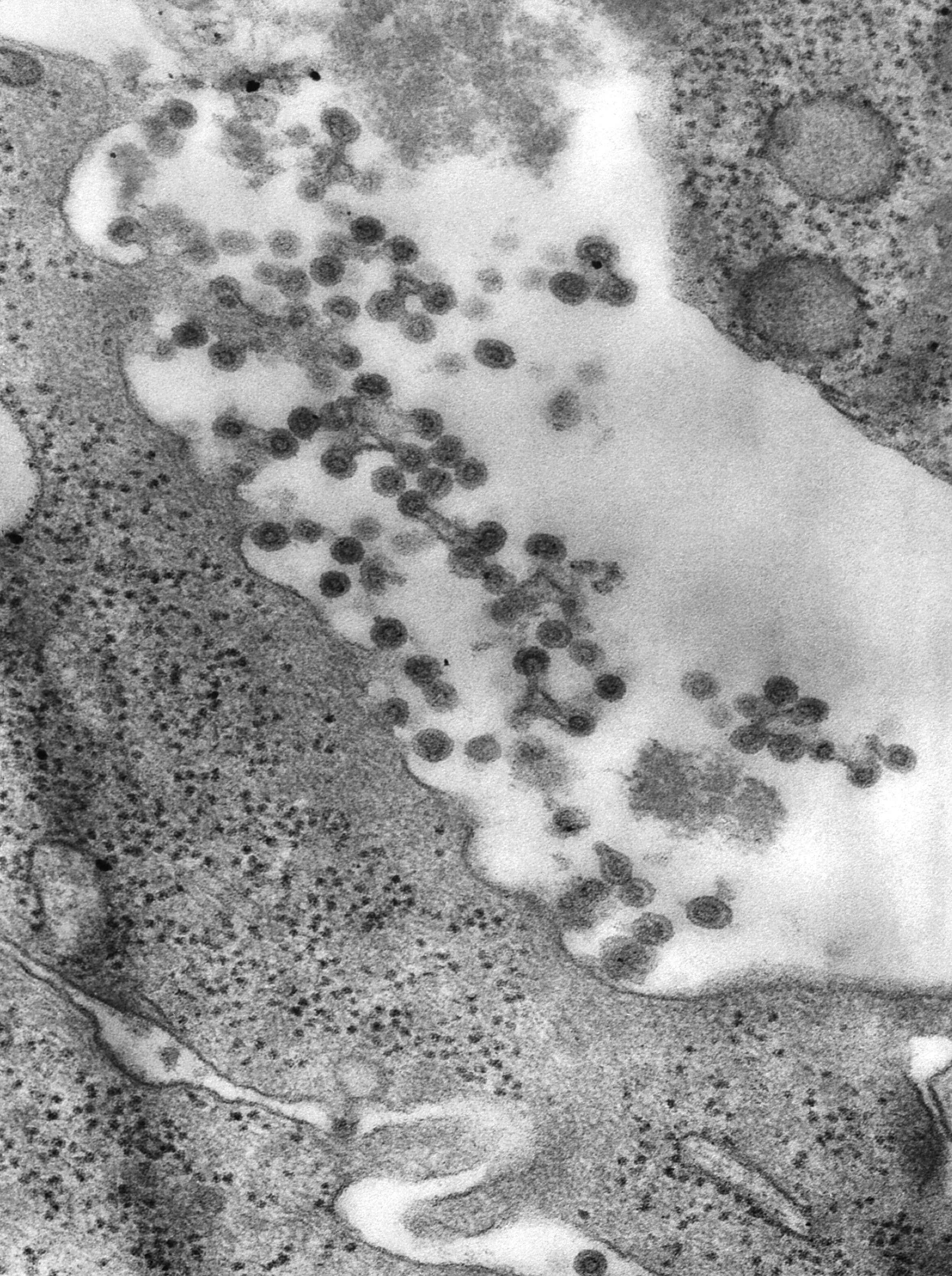 Image of Rubella virus