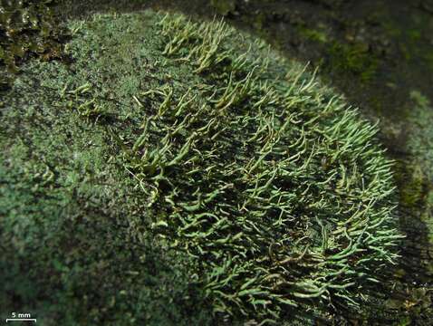 Image of nail lichen