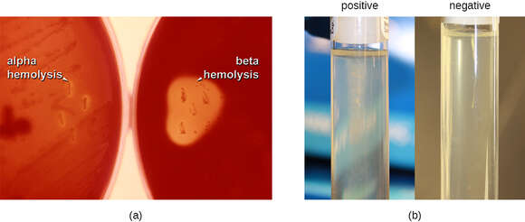 Image of Streptococcus mitis