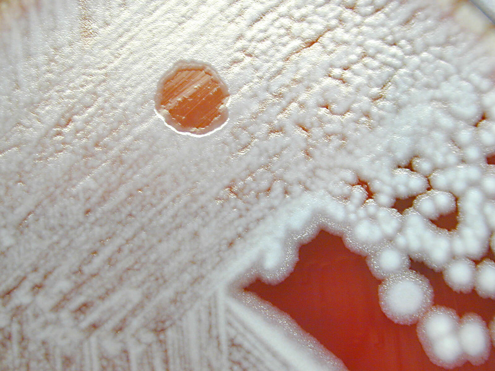 Image of Bacillus anthracis