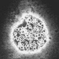 Слика од Hepatovirus