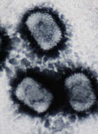 Image of Orthopoxvirus