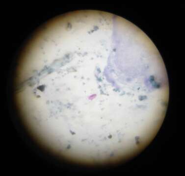 Image de Cystoisospora