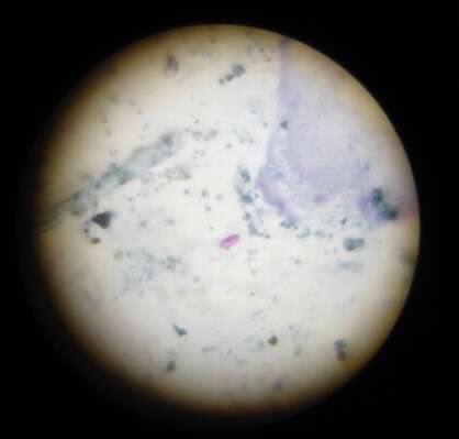 Image de Cystoisospora