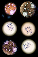 Imagem de Cryptococcus