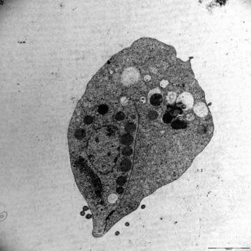 Image of Trichomonas Donné