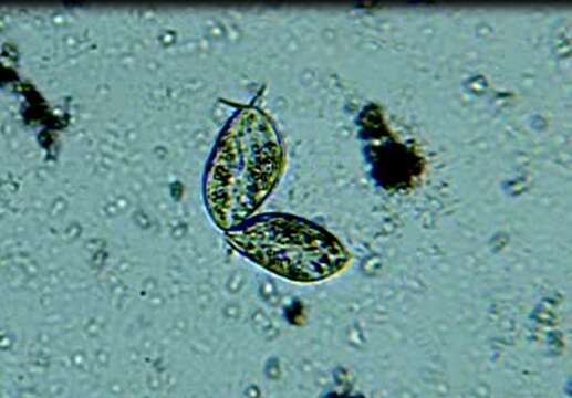 Image of Paramecium aurelia