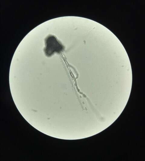 Image of Aspergillus fumigatus Fresen. 1863