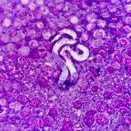 Image of Heartworm