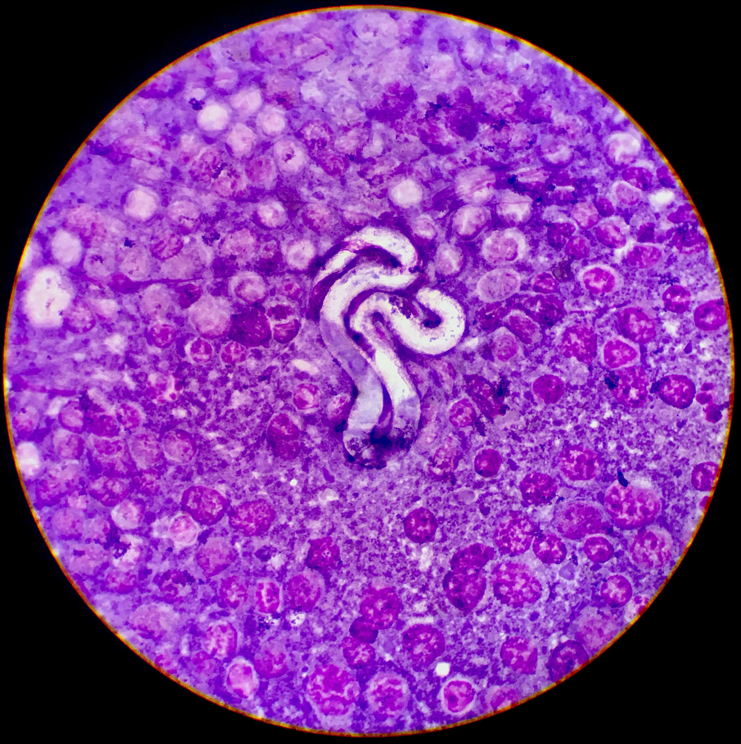 Image of Heartworm