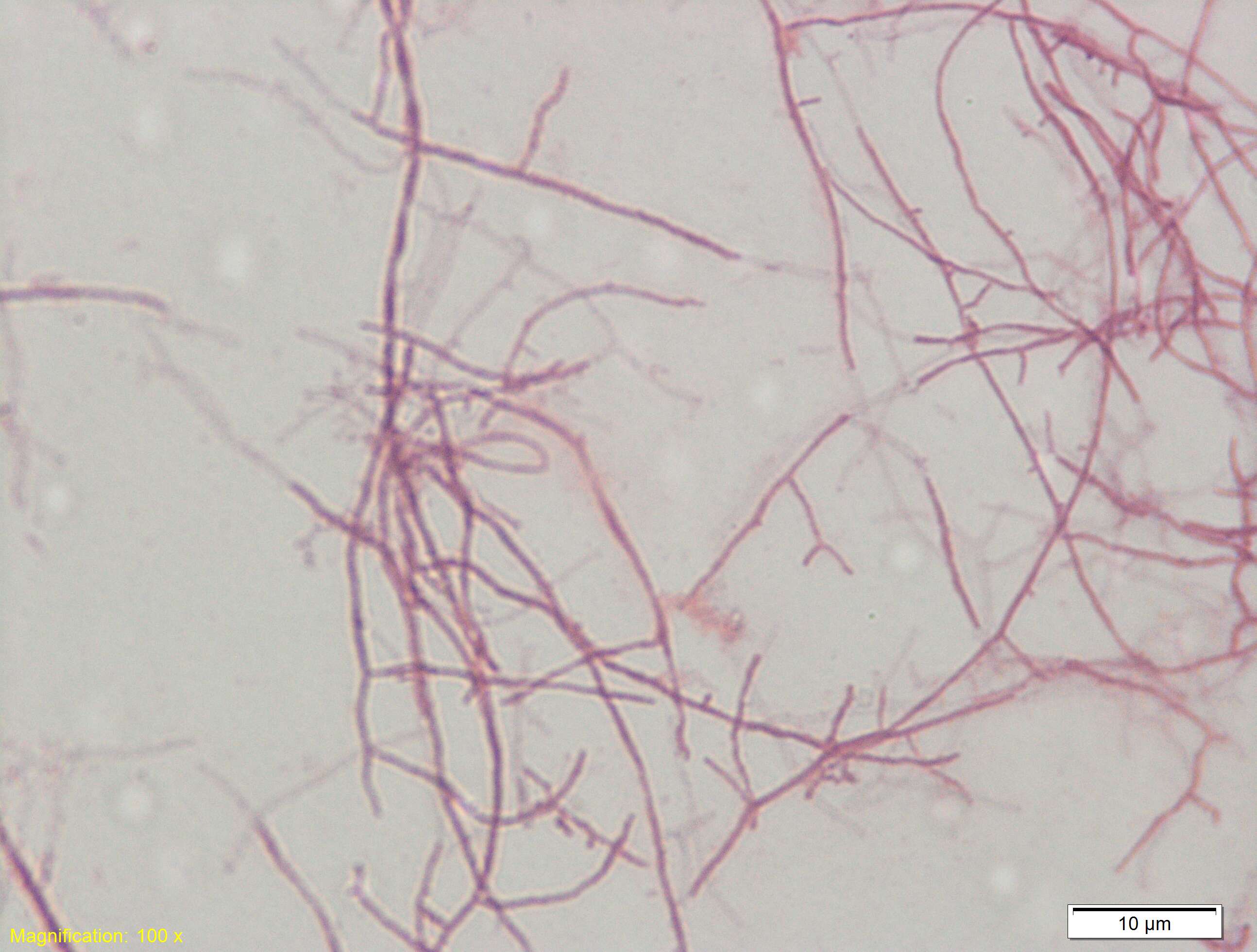 Image of Actinomycetales