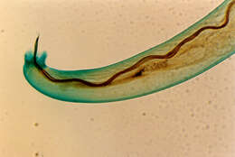 Imagem de Angiostrongylus cantonensis