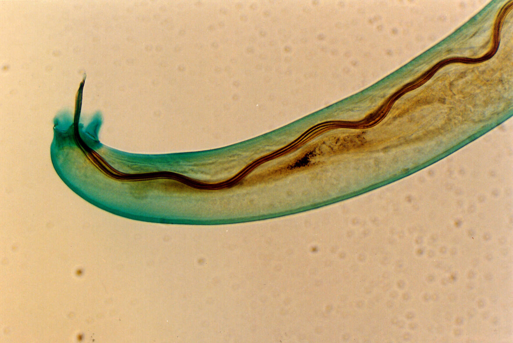 Image of Rat lungworm