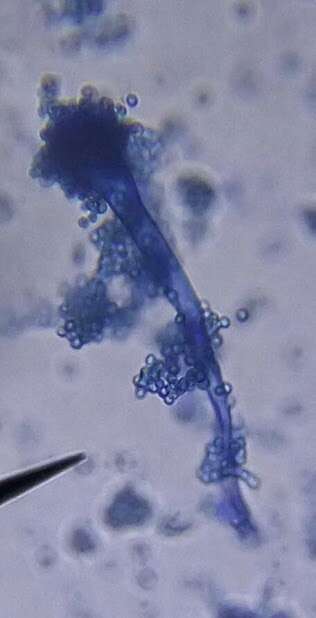 Image of Penicillium