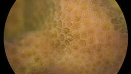 Image of Finger Coral