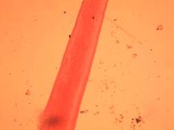 Image of Pinworm